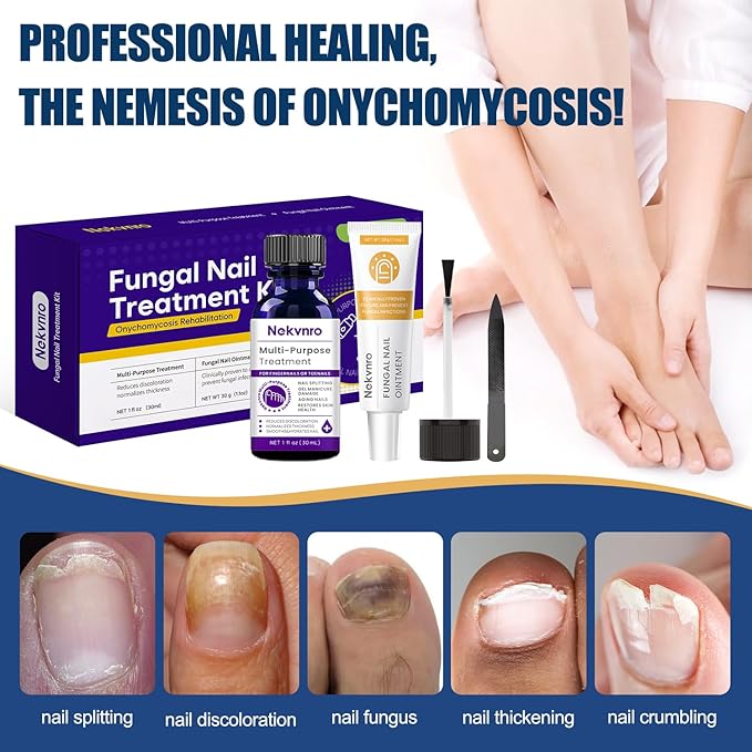 Toenail Fungus Treatment Extra Strength,Nail Fungus Treatment for Toenail,Fungus Nail Treatment Liquid 30ML and Fungal Nail Repair Cream.