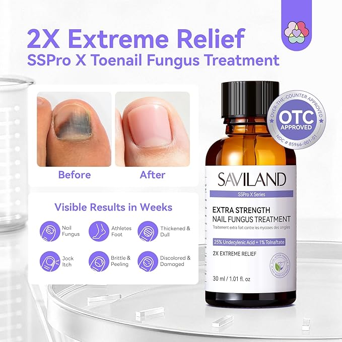 SAVILAND Toenail Fungus Treatment Extra Strength: 2X Extreme Nail Repair for Discolored and Damaged Nails Toenail Softener Yellow Toenail Foot Toe Thick Nail Fungus Treatments Solution 1 fl oz