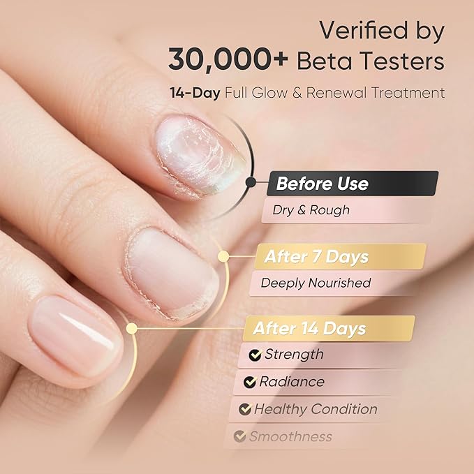 Cuticle Oil for Dry Cuticles – Hydrating Nail & Cuticle Care with Jojoba, Rose Oil & Vitamin E
