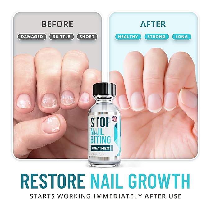 Stop Nail Biting Treatment for Kids, Clear Bitter Nail Polish to Gently Break the Habit, Safe & Comforting Nail Biting Prevention for Kids, Supports Healthy Nail Growth, 0.5 fl oz - Packaging May Vary