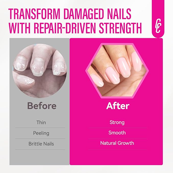 Nail Repair for Women: 8 in 1 Pink Nail Hardener Extra Strong and Growth - 15ML Natural Nail Polish Hardener Ridge Filler Strengthener for Weak and Damaged Nails 15ml