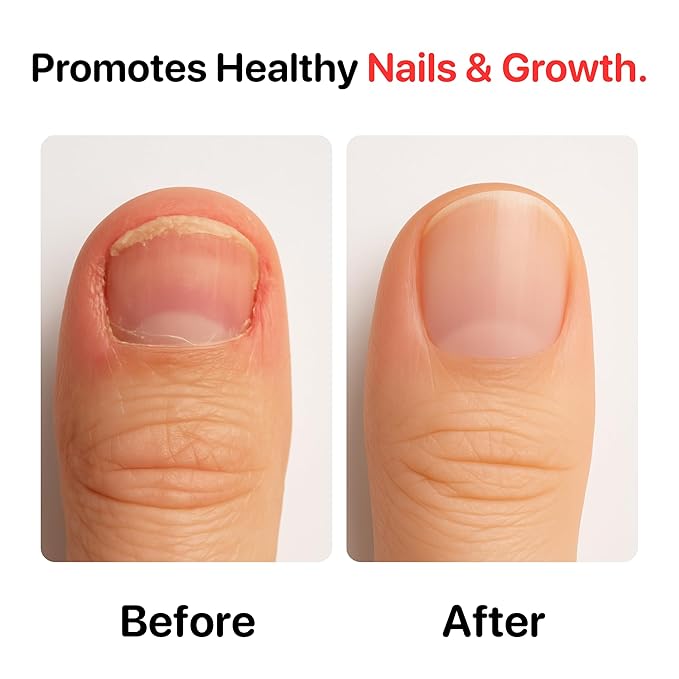 C CARE Nail Biting Prevention for Kids & Adults | Safe, Bitter, Clear, Thumb Sucking Deterrent | Stop Nail Biting Treatment for kids & Adults, Fast Drying, Easy Brush On, 0.5 fl oz