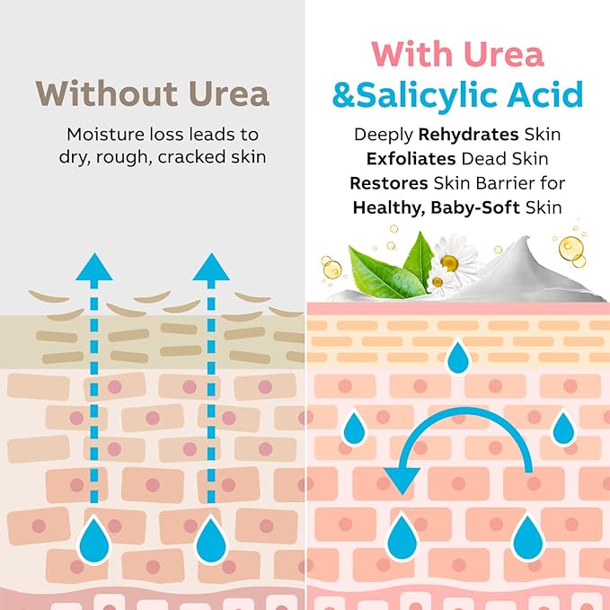 Urea Cream 40 Percent for Feet Maximum Strength, Urea Foot Cream for Dry Cracked Heels Feet Knees Elbows, 40% Urea Foot Repair Lotion 5.3 OZ