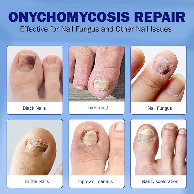 Fungal Nail Patches for Toenails, 42 Count - Nail Repair Patches with 8-Hour Adhesion, for Discolored & Damaged Toenails Care, Overnight Renewal for Men & Women