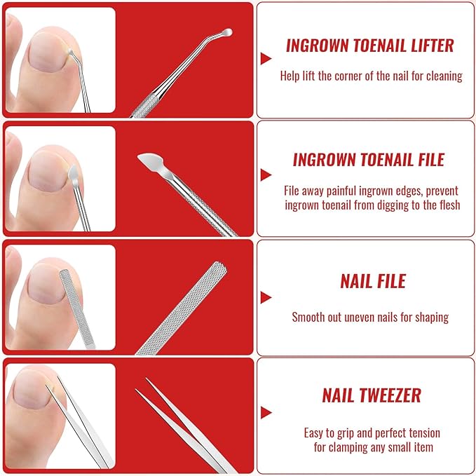 Ingrown Toenail Removal Kit, Ingrown Toenail Tool Kit with Ingrown Toenail Corrector, Ingrown Toenail Drops, Corrector Patch, Toenail Clipper, Nail File Lifter Tools