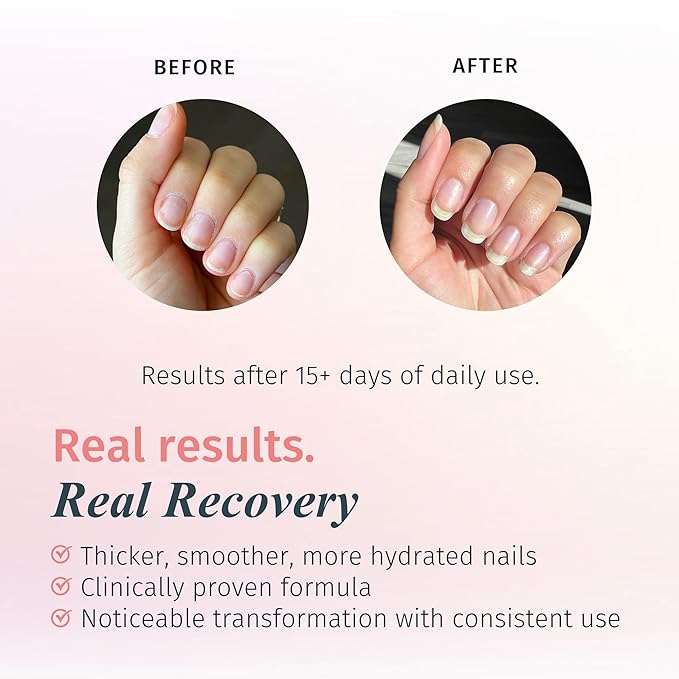 duri Rejuvacote 1 Nail Growth System - Original Maximum Strength Formula - Nail Strengthener and Nail Growth - Base and Top Coat - Pack of 2-0.45 fl. oz.