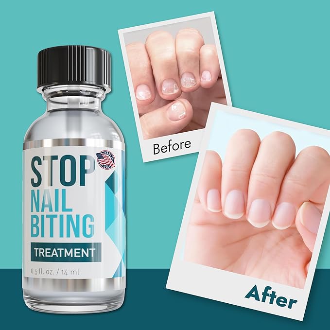 Stop Nail Biting Treatment - Clear, Bitter-Tasting Nail Polish To Stop Nail-Biting - Easy To Apply and Safe For Children - Nail Strengthener Solution - Nail Care for Healthy Nail Growth (2x0.5 fl oz)