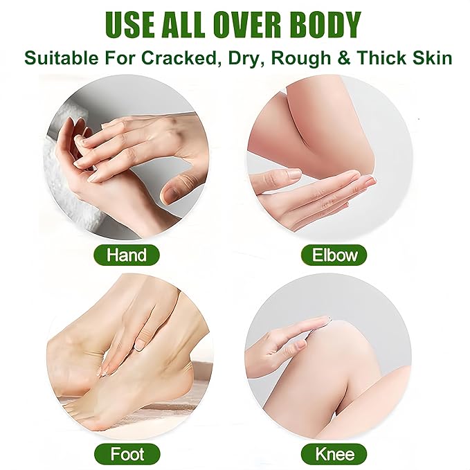 Urea Heel Balm Stick for Feet and Hands,3Pcs Moisturizing Heel Balm for Dry Cracked Feet, Hydrating Stick for Foot & Hands, For Women & Men, Travel Size(Peach, Urea and Honey)