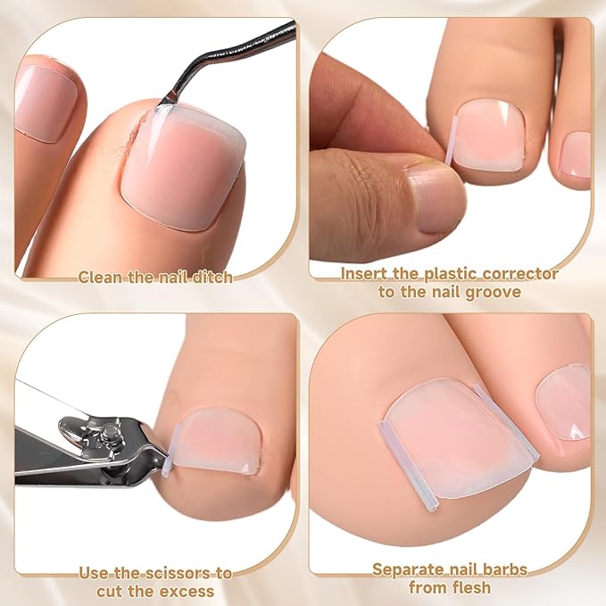 201 Pcs Ingrown Toenail Corrector Kit with Breathable Correction Strips, Curved Nail Patches, Toenail Lifter Tools, Complete Home Pedicure Set for Daily Nail Grooming & Nail Shaping