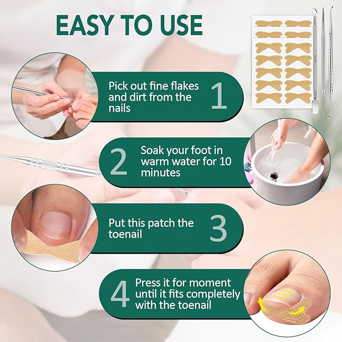Ingrown Toenail Treatment, 100 Pcs Breathable Ingrown Toenail Strips, Toenail Corrector Patch with 3 Pedicure Tools for At-Home Pedicure and Foot Care (Style 02)