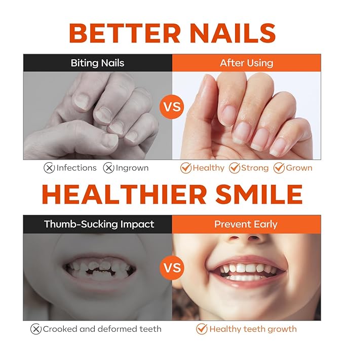 modelones Nail Biting Treatment for Kids Stop Biting Pen Bitter Nail Biting Prevention for Kids Thumb Sucking Deterrent Quick Dry No Bite Nail Polish Nail Repair for Damaged Nails Care 0.24 Fl Oz