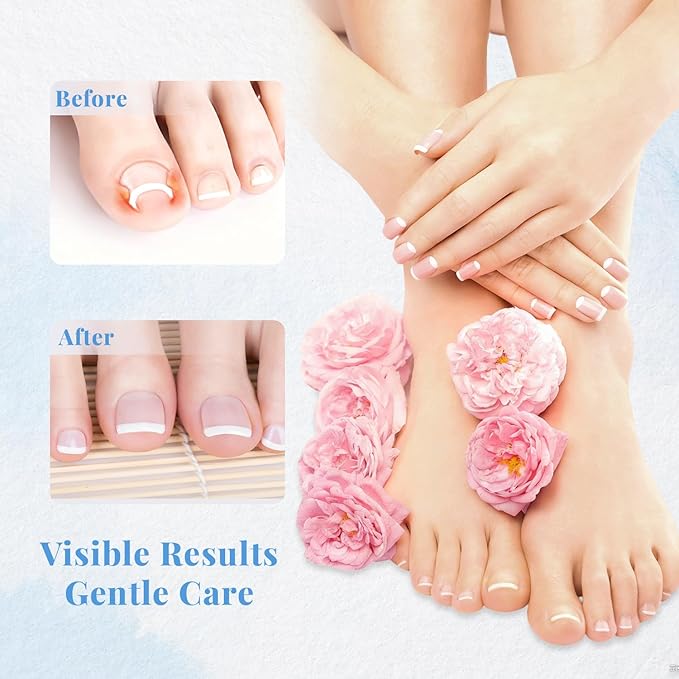 Professional Ingrown Toenail Set, Nail Care, Professional Pedicure Tools Set for Toenail Care, Stainless Steel Clippers, Lifter, File & Nail Cleaner, Painless File and Lifter Pedicure Tools