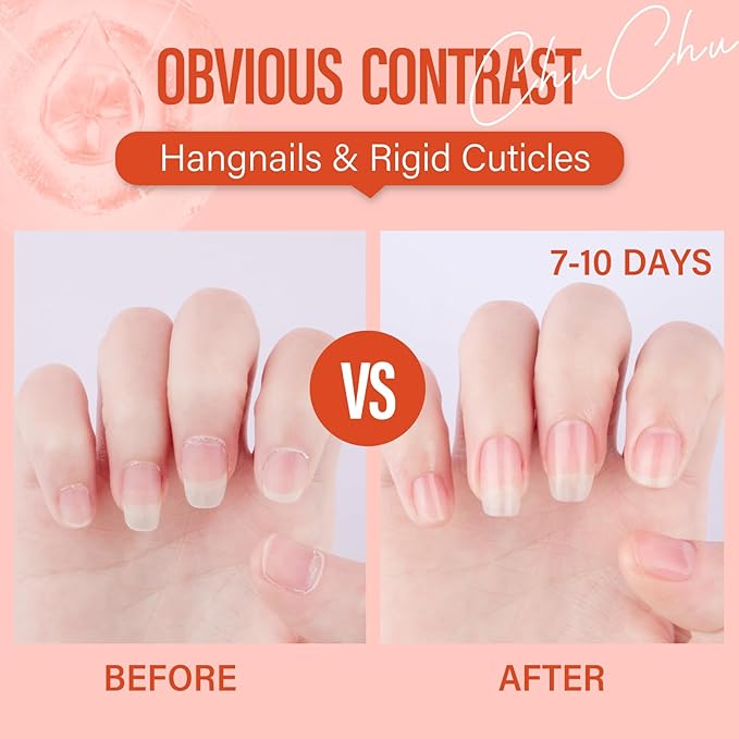 CHUCHU Cuticle Oil for Nails,Jojoba Nail Cuticle Oil Contain Vitamin B & E,Moisturizes Cuticle and Nail's Skin,Strengthens Nails,Prevents Hangnails and Chapped,Peach 15ml