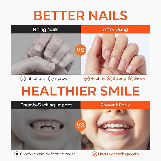 modelones Nail Biting Treatment for Kids 2 Pcs Nail Biting Prevention for kids Quick Dry Thumb Sucking Deterrent Bitter Stop Nail Biting Pen No Bite Nail Polish Sets 0.58 Fl Oz