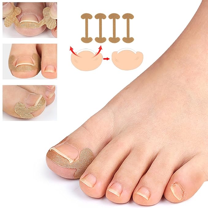 Professional Ingrown Toenail Set with Breathable Ingrown Toenail Strips,Toenail Correction Strips, Curved Toenails Corrector Patch, Painless File and Lifter Pedicure Tools