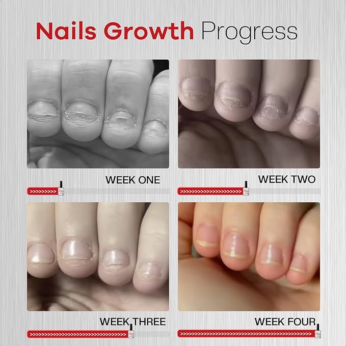 Nail Biting Prevention For Kids: 12ml Extra Strong Nail Biting Treatment Anti Toddler Thumb Sucking Deterrent Stopper Nail Repair for Damaged Nails 48H Long Lasting Matte Odorless Onychophagy Relief