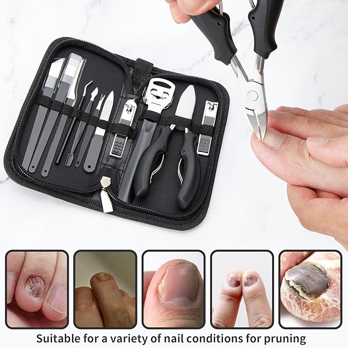 Ingrown Toenail Clippers, Upgraded 11Pcs/set Nail Treatment Foot Tool Kit, Pedicure Knife Nail Lifter Cutter Cuticle Manicure Kit Foot Care Toe Nail File for Podiatrist Ingrown Seniors Adult