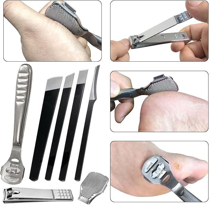 37 Pcs Callus Shaver for Feet Set, Foot Callus Shaver, (1 Foot Razor for Callus Removal &1 File Heads & 4 Pedicure Knife & 1 Nail Clippers & 30 Replacement Slices Blades)