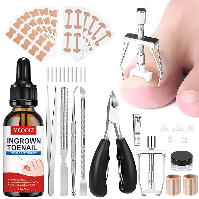 Ingrown Toenail Removal Kit, Ingrown Toenail Tool Kit with Ingrown Toenail Corrector, Ingrown Toenail Drops, Corrector Patch, Toenail Clipper, Nail File Lifter Tools