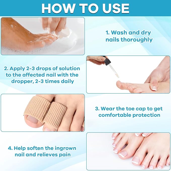 Ingrown Toenail Drop - Ingrown Toenail Pain Reliever and Softener Kit for Men Women Ingrown Toenail Corrector Drops