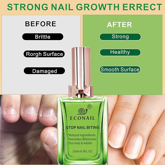 Upgraded Nail Biting Treatment for Kids & Adults ultra bitter for stubborn habits, Fast Drying, Stops Thumb Sucking, Helps Repair & Strengthen Damaged Nails, 0.5 fl oz (15ml)