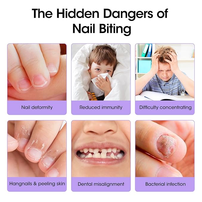 Gellen Nail Biting Treatment for Kids & Adults - 15ml Safe Nail Biting Prevention Thumb Sucking Deterrent Bitter Taste No Biting Nail Polish Nail Care Solution to Help Stop Finger Biting & Nail Repair