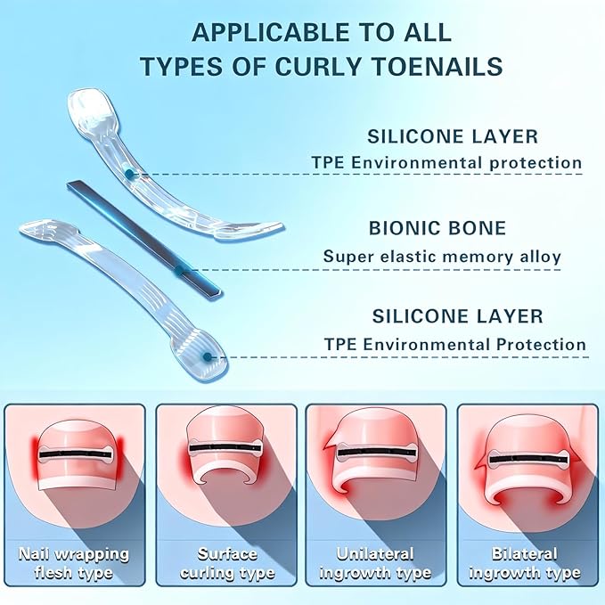 Titanium Alloy Ingrown Toenail Treatment - Professional Home Care for Curved Nails - Waterproof, Nail Tools and Ingrown Toenail Removal Kit,Ingrown Toenail Corrector(0.59/0.67in)