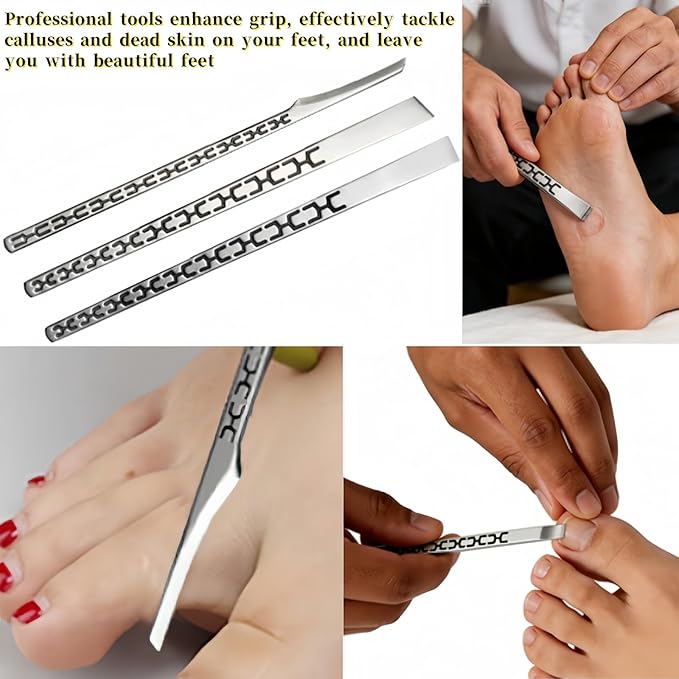 4 PCS Stainless Steel ingrown toenail Pedicure Knife Set,Professional Pedicure Knife Set,Dead Skin Corn Foot Callus Remover Kit