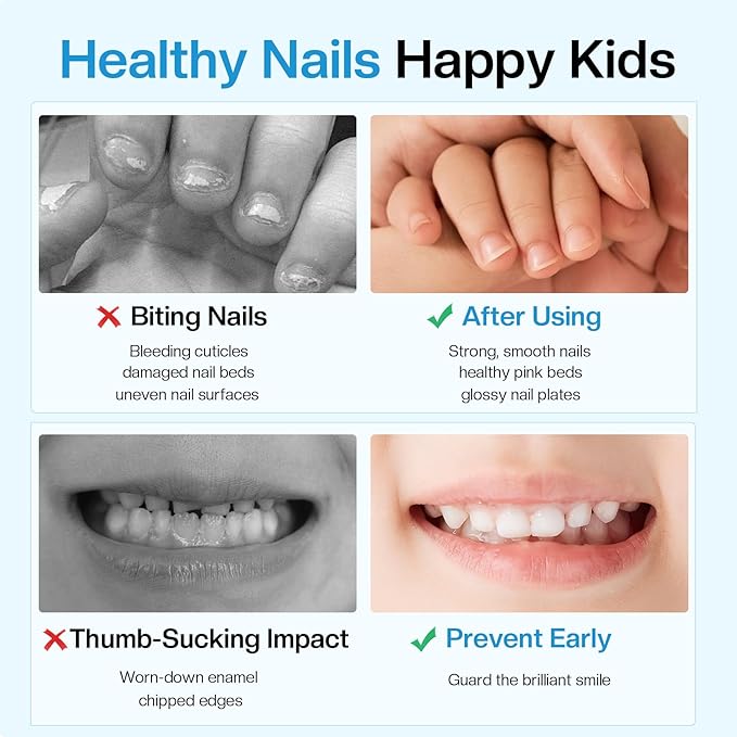 Nail Biting Treatment For kids Thumb Sucking Deterrent: No Bite Nail Polish Nail Biting Prevention Safe Bitter Nail Polish For Nail Biters Kids Stop Biting For Adults Quick Dry Lasting
