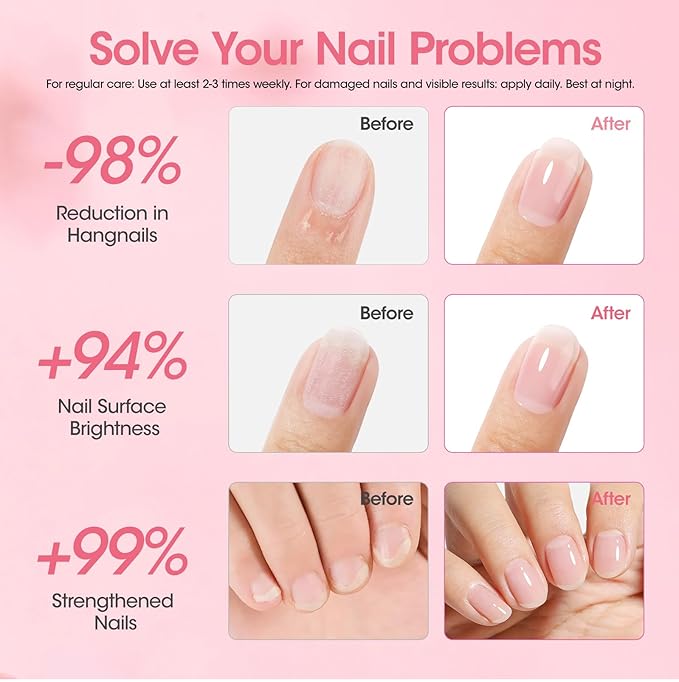 Gellen Peelable Nail Strengthener Mask, Air Dry Peel-Off Nail Mask for Nail Strengthener and Growth, Nail Repair Masque for Damaged Weak Thin Nails, Natural Nail Treatment, Rose Scent