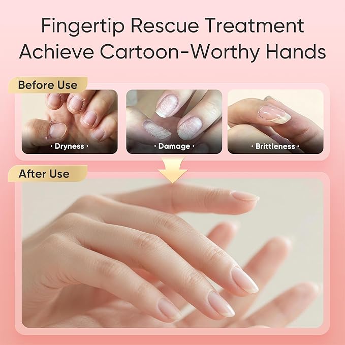Cuticle Oil for Dry Cuticles – Hydrating Nail & Cuticle Care with Jojoba, Rose Oil & Vitamin E