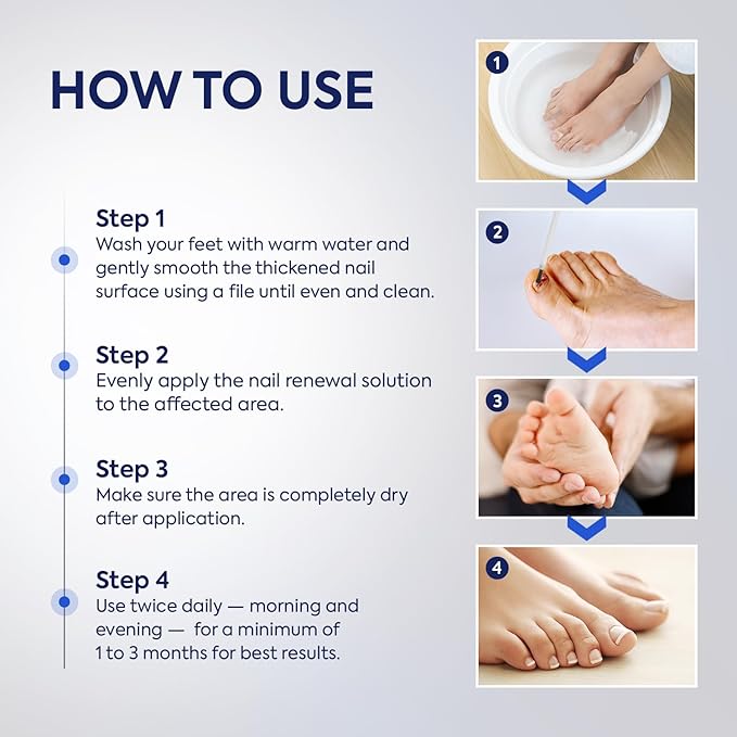 Toenail Fungus Treatment Extra Strength: 25% Undecylenic Acid & Tea Tree Oil - Repairs Yellow Thick Brittle Toe and Fingernails - 2 Bottles with 14 Patches