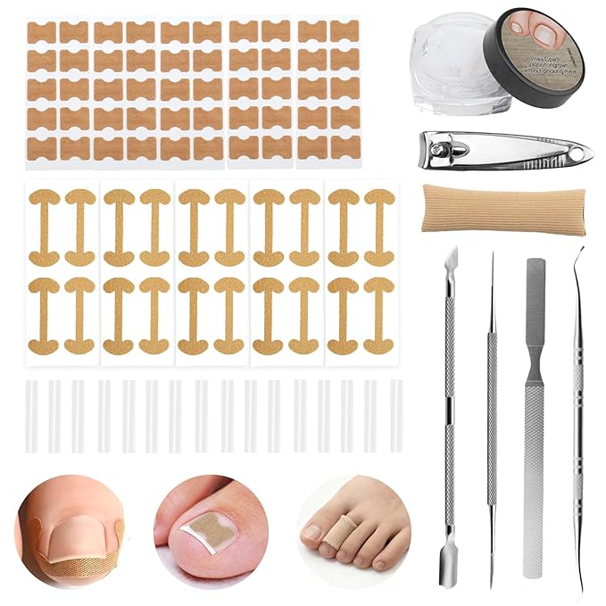 Ingrown Toenail Corrector Set with Breathable Correction Strips, Upgraded Ingrown Toenail Treatment Kit, Curved Toenails Corrector Patch, Pedicure Tools, for Home Use Women Man