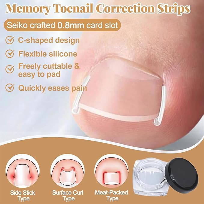 Ingrown Toenail Removal & Corrector Kit for Fast Pain Relief - Professional Ingrown Toenail Treatment Kit with Curved Strips, Breathable Patches & Pedicure Tools, Prevention & Healthy Nail Growth