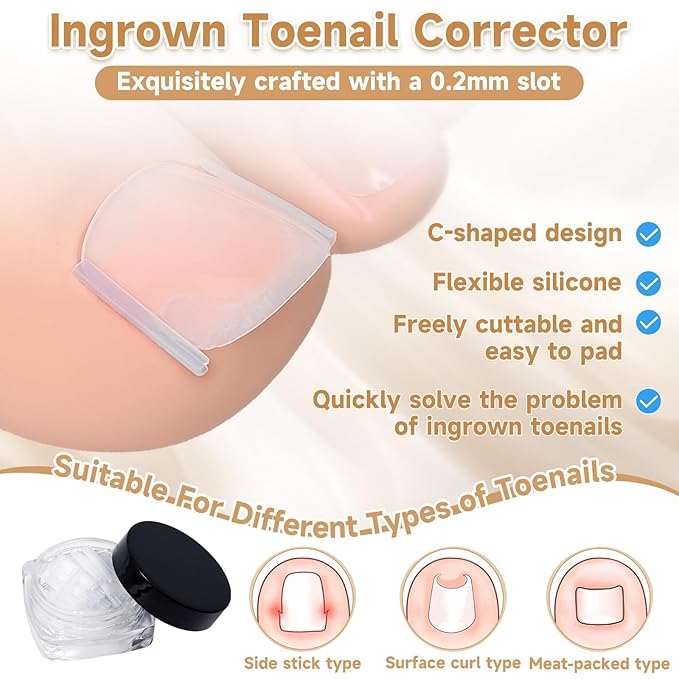 201 Pcs Ingrown Toenail Corrector Kit with Breathable Correction Strips, Curved Nail Patches, Toenail Lifter Tools, Complete Home Pedicure Set for Daily Nail Grooming & Nail Shaping