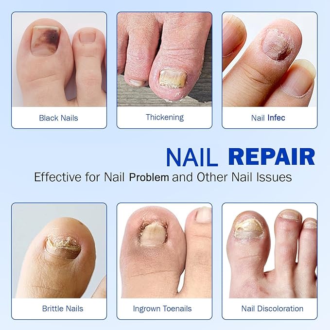 Nail Patches 42PCS, Overnight Toenail Treatment Extra Strength Repair Pads, Multi-Purpose for Thick, Cracked & Discoloured Nails, Long-Lasting 8-Hour Repair, Nail Care and Repair for Damaged Nails