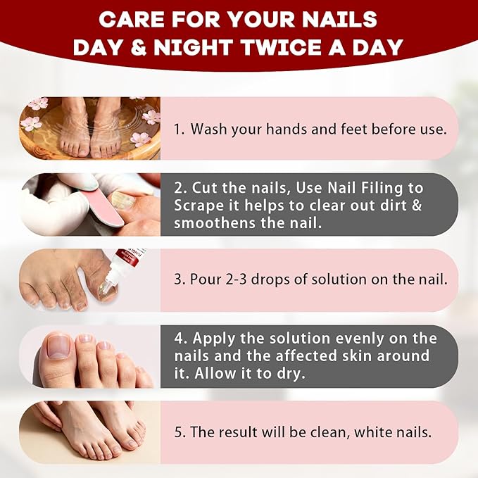 Fungi Nail Toenail Treatment,Gentle Formula, Effectively Improves Nails for a More Beautiful Appearance (1Pcs, 0.5 oz)