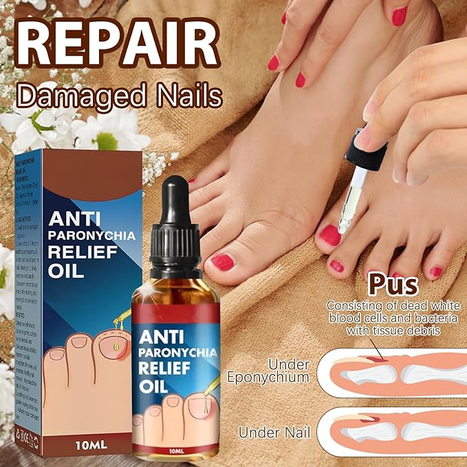 2PCS Paronychia Nursing Oil, German Toenailcare Anti Paronychia Relief Oil, Repair for Damaged Discolored Thick Nails