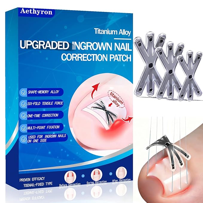 Ingrown Toenail Treatment with Upgraded 6-Angle Shape,Titanium Alloy Ingrown Toenail Corrector for Quick Relief,At-Home Ingrown Toenail Removal Kit for Toenail Curled Corrector,9Pcs