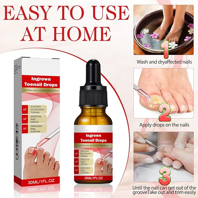2PCS Ingrown toenail drops,Ingrown Toenail Relief,Easy Trim Ingrown Toenail Tools,Toenail Fluid With Silicone Gel Toe Caps Essential Oil Diffuser,Ingrown Toenail Reliever and Softener Kit