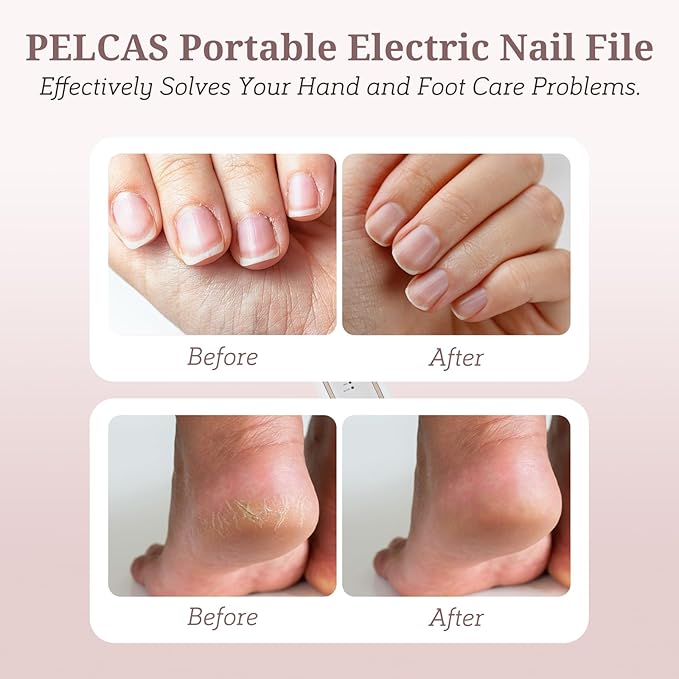 PELCAS Electric Nail File, 5 Speeds Nail Grinder for Thick Toenails, Cordless Nail Drill, Manicure and Pedicure Kit with LED Light, Toenail Grinder for Human, Thick Toenails, Natural & Acrylic Nails