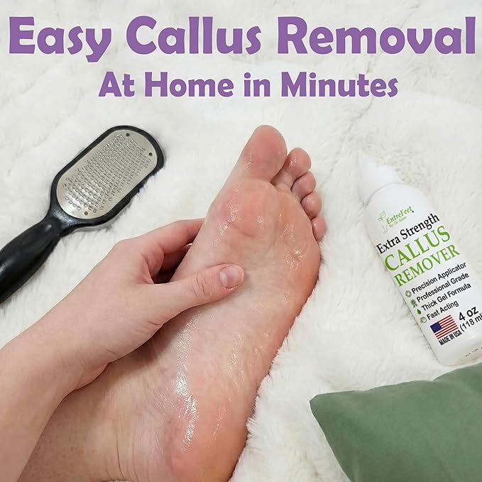 Dr. Entre's Callus Remover Gel & Foot File: Extra Strength Callus Remover for Feet, Foot Callus Remover Care, Pedicure Tools Supplies, Spa Kit, Dead Skin Scrubber, 4 oz