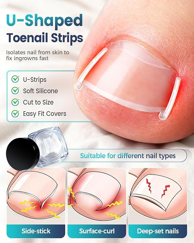 Professional Ingrown Toenail Corrector, 2-in-1 Ingrown Toenail Removal Kit with U-Shaped Strips and Correction Patch, Ingrown Toenail Clippers Tool Set- Effective Removal of Ingrown Toenails (Gold)