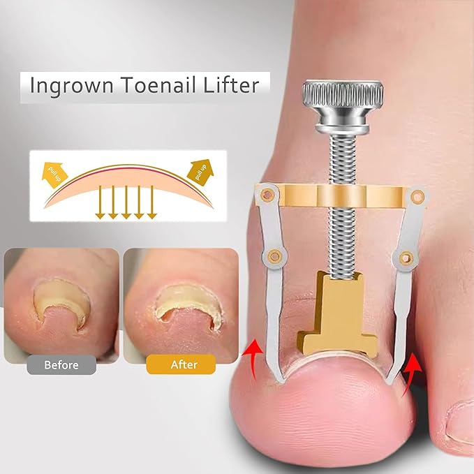 Ingrown Toenail Clipper for Senior Nail Clipper for Men Women Toenail Clippers for Ingrown Nails Removal Set Thick Nail Cutter Toe Nails Clipper Kit (A-6)
