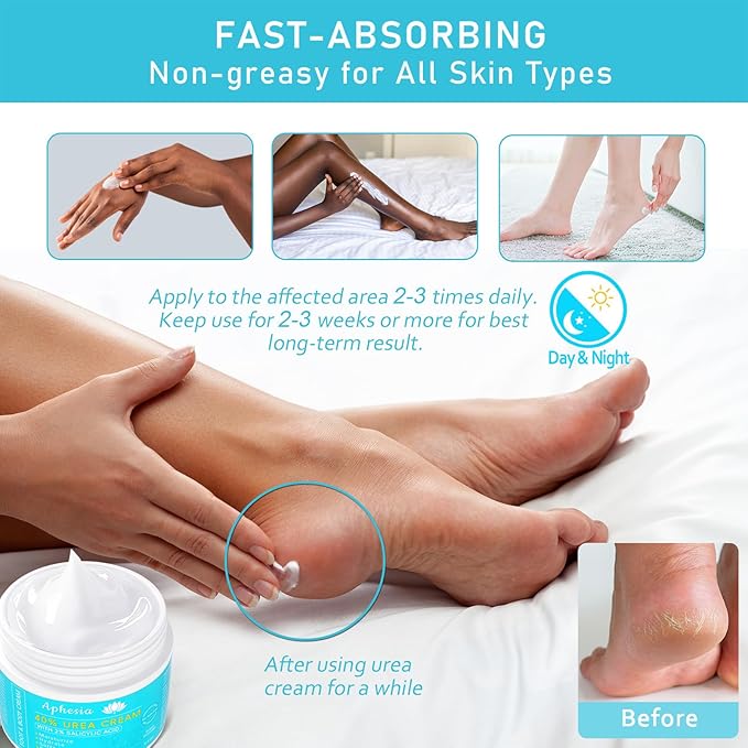 Urea Cream 40% Maximum Strength with Vitamin E & Salicylic Acid - Foot Cream for Winter Dry Cracked Heels - Intense Moisturizer for Hands, Feet & Body - Callus Remover - Lightweight Non-Greasy Formula