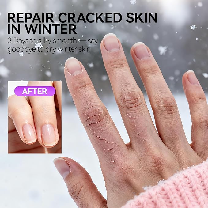 gelike ec Cuticle Cream for Dry Damaged Cuticles: Organic Moisturizer Nail Care Balm Cuticle Remover for Rough Hands Cracked Rigid Foot - Professional Nail Repair for Salon Home - Peach Scent