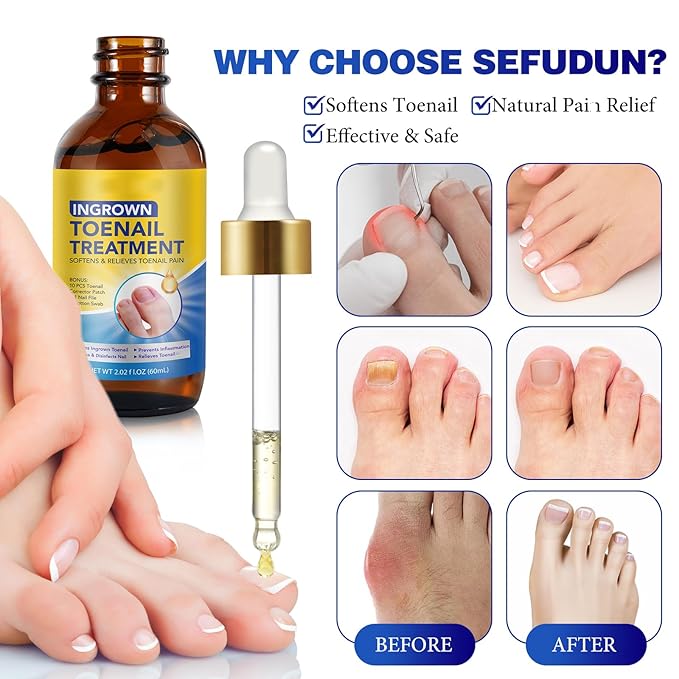 Nail Removal Kit,Toenail Drops,Softens Nails,Nail Care Tool Set,Ingrown Toenail Corrector,Corrector Patch,Nail File,60ml