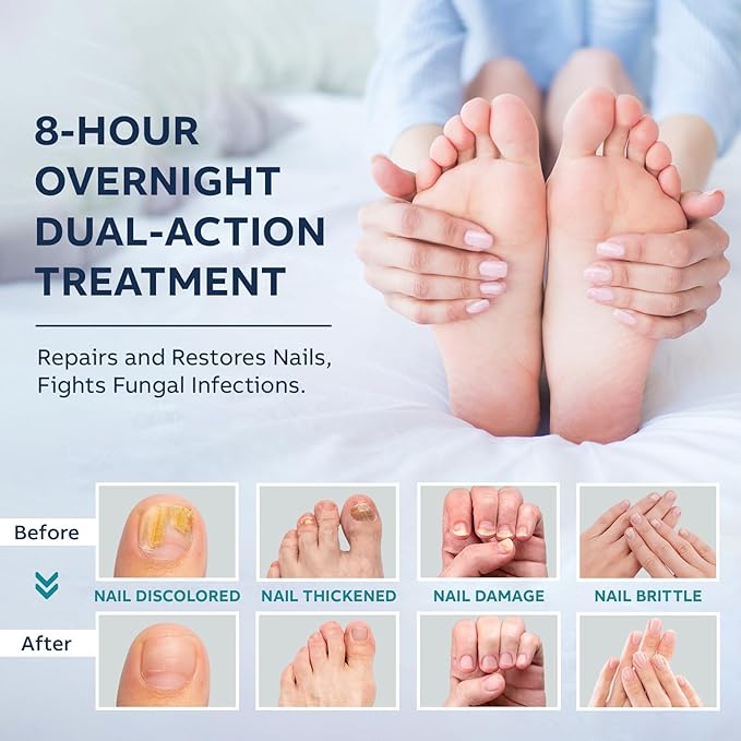 Toenail Fungus Treatment Extra Strength Kit: Nail Repair Liquid Solution and Patches - Nighttime Nail Patches Renewal - Fast Acting Drops with Undecylenic Acid, Natural Oil for Toe Finger Nails