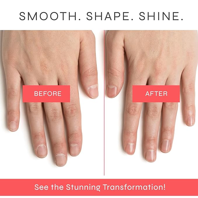Dr. Dana No Polish Manicure Set - Shine and Strengthen Your Nails with Natural Glycolic Serum, Cuticle Oil, Nail Buffer Block, and Glass Nail File, Nail Care Kit for Healthy Nails