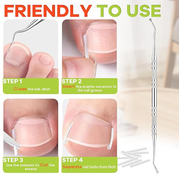 Ingrown Toenail Corrector Kit - Breathable Correction Strips with Nail Lifter Tools, Clippers & File, Toenail Relief for Edges, Home Care Solution